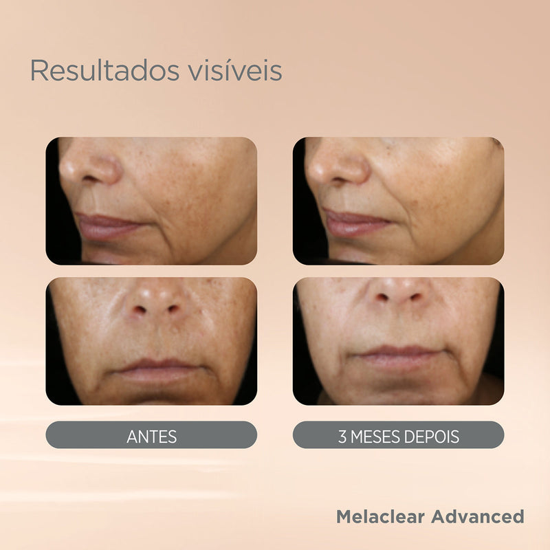 Melaclear Gel sérum antimanchas