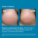 ISDIN ureadin podps Gel-Óleo Hidratante Para Pés Secos