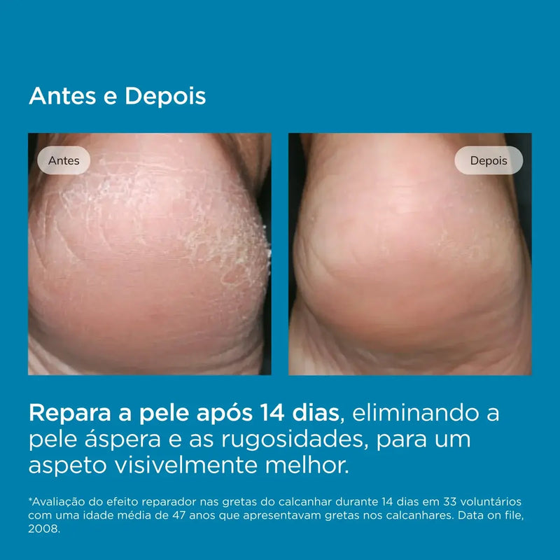 ISDIN ureadin podps Gel-Óleo Hidratante Para Pés Secos