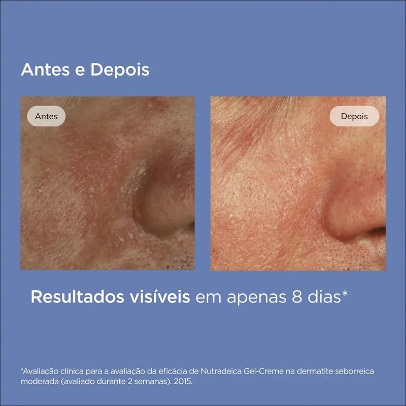 Nutradeica  Gel Creme Facial tendência Pele Seborreica
