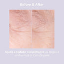 Glicoisdin® 15 Moderate Gel facial com efeito peeling