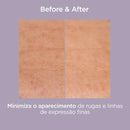 Glicoisdin Gel 25 Gel facial com efeito peeling