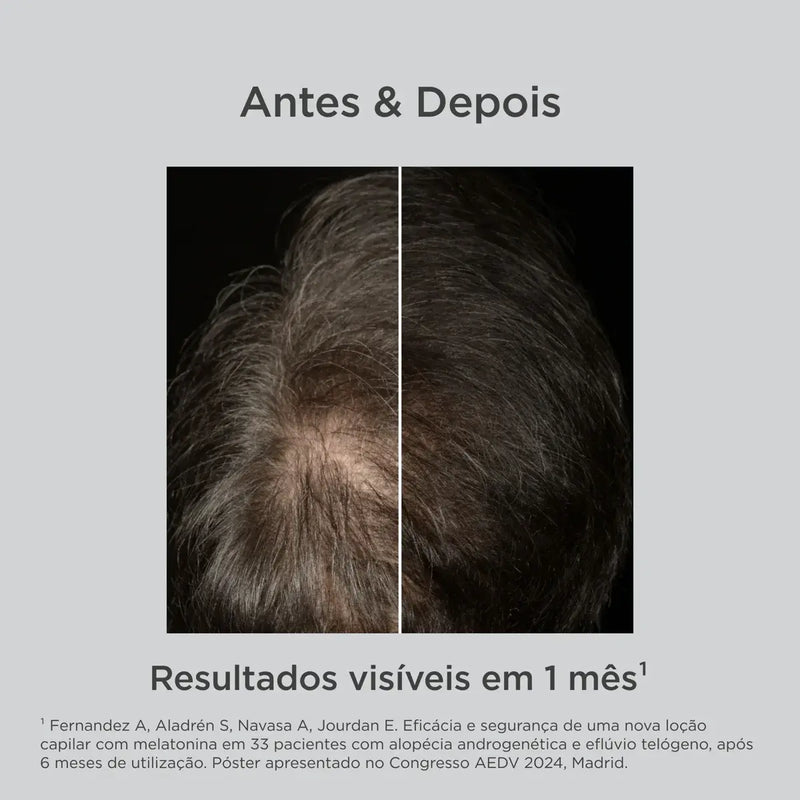 ISDIN HAIRCARE Antiqueda Loção Que favorece o crescimento 100ml