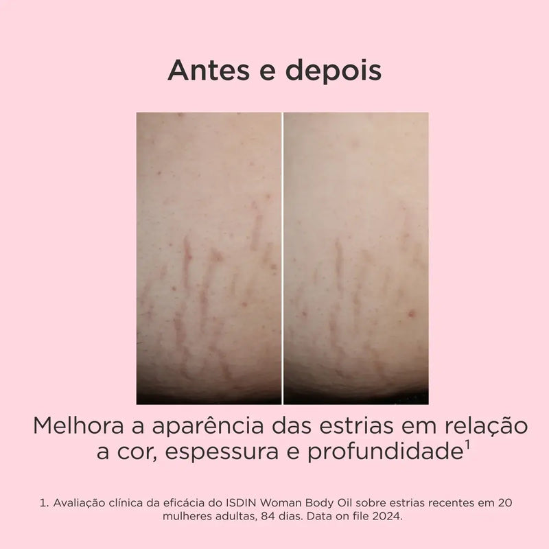 Óleo Corporal Feminino ISDIN 100ml